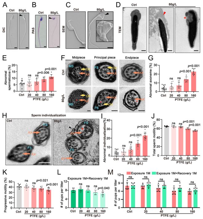 浙大院士团队新发现：不粘锅涂层产生的微塑料会损害男性生育力并提出新型修复疗法！(图3)