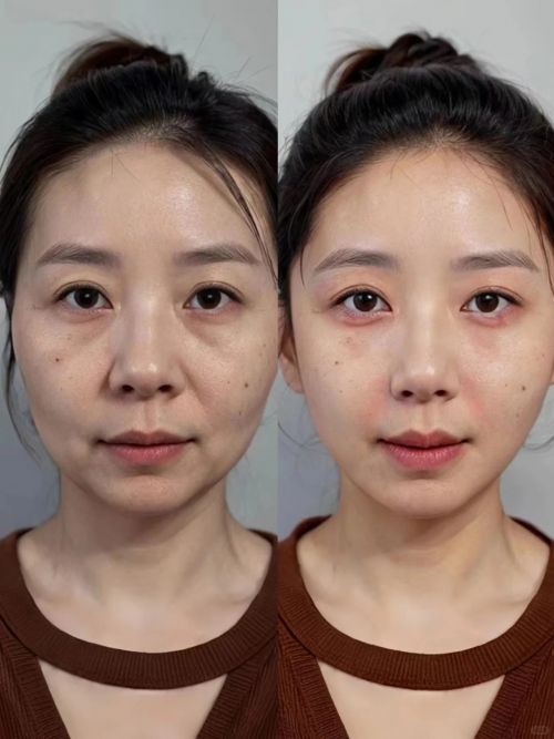 抗皱用什么产品好？10款有效的抗皱护肤品分享实测不踩雷(图5)