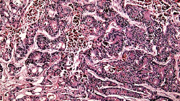 再生骨髓干细胞的功效(图2)