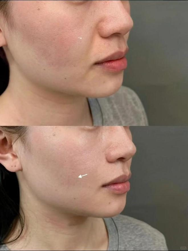 什么化妆品抗皱好？2025抗皱好的护肤品分享性价比高的推荐(图4)