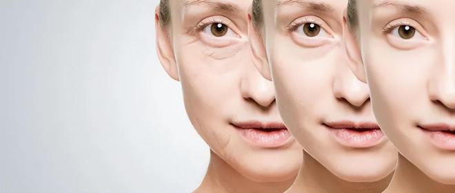 安然纳米植物干细胞技术让抗衰成为一种新的解决方案(图4)