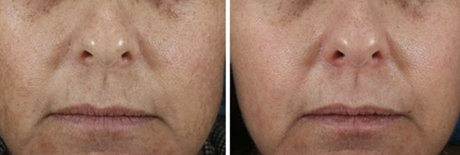 果然一山难容二虎啊(图5)