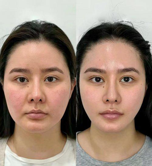 高口碑抗皱紧致护肤品十大排名抗皱紧致护肤品必看分享(图6)