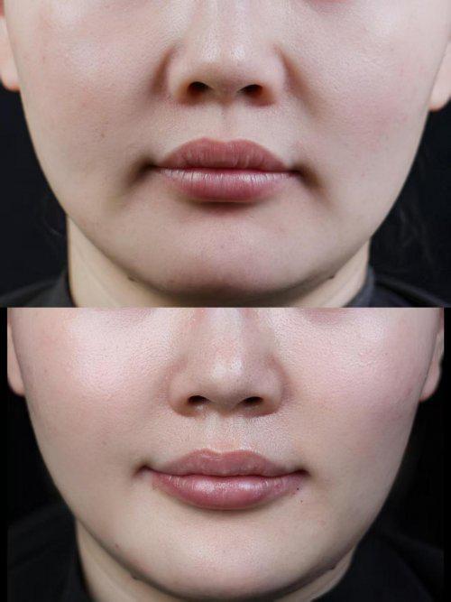 哪个品牌抗皱效果好？40岁抗皱紧致十大排名护肤品种草重获紧致(图5)