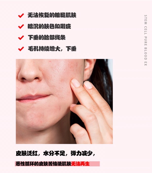 玫瑰干细胞精华水是什么？