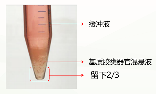 人神经干细胞培养方法及诱导形成脑类器官(图3)