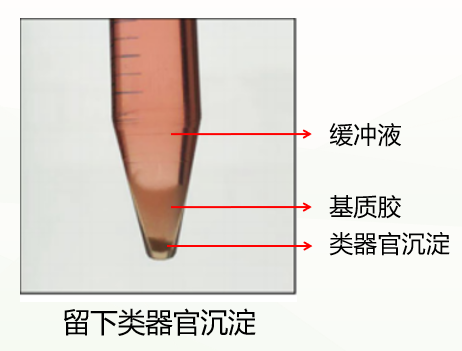 人神经干细胞培养方法及诱导形成脑类器官(图9)